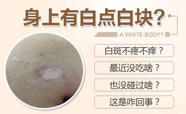 合肥華研白癜風醫院